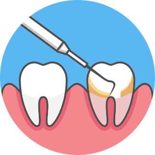 歯 周 病 の 進行 を 知る ため に 歯 周 ポケット の 深 さ を 測る 道具 は 何